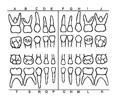 20+ Free Printable Dental Chart Forms & Templates (PDF) » Template Republic