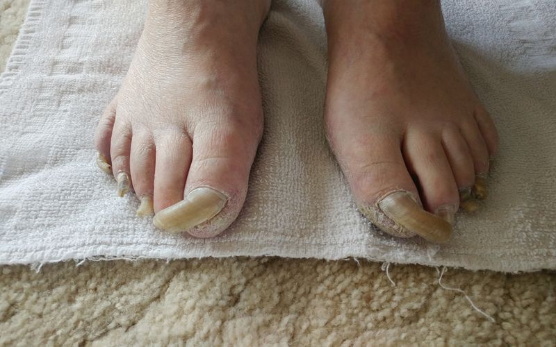 Medical Pedicures Pedicures Boise, Idaho 208853TOES