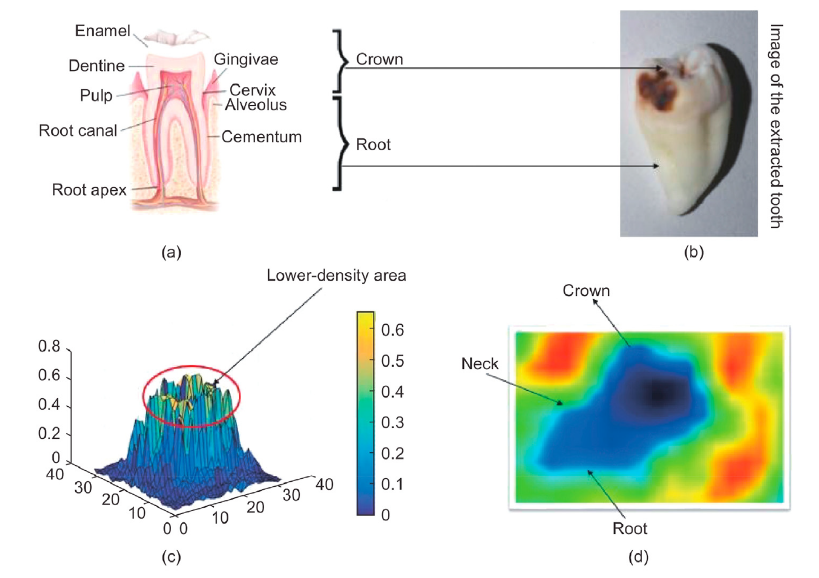 Terahertz imaging technology is an innovative tool for medical