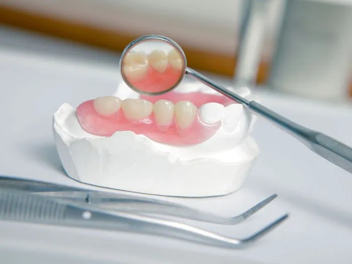 Dentures Decatur AL Terry Family Dentistry