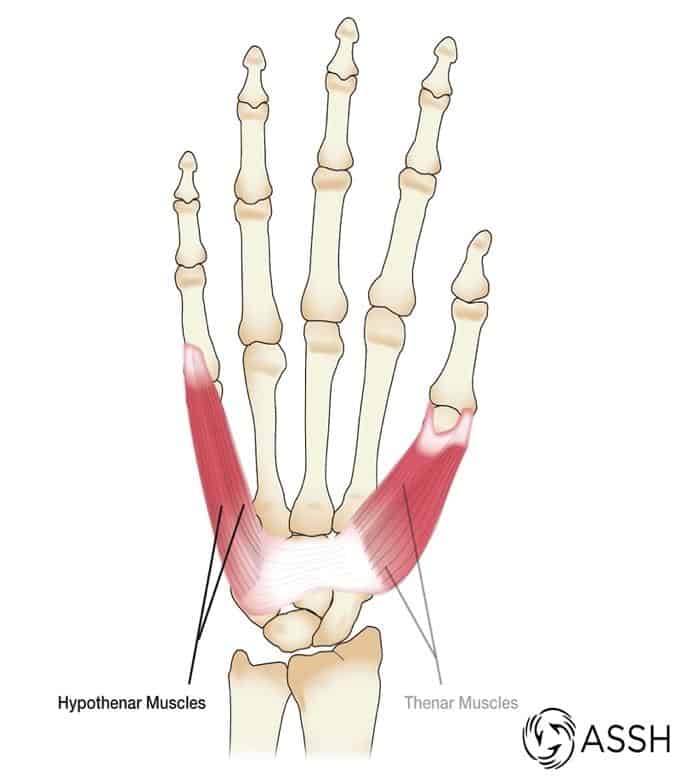 Muscles of the Upper Extremities Teton Hand Surgery