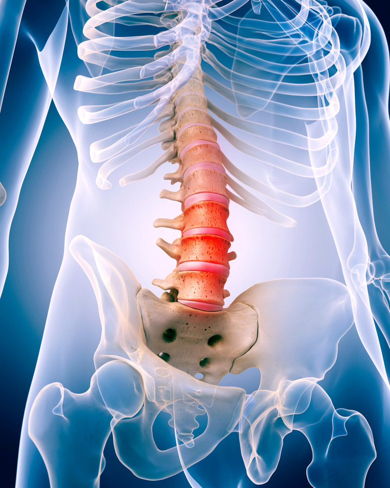 Lumbar Discography - Texas Back Institute