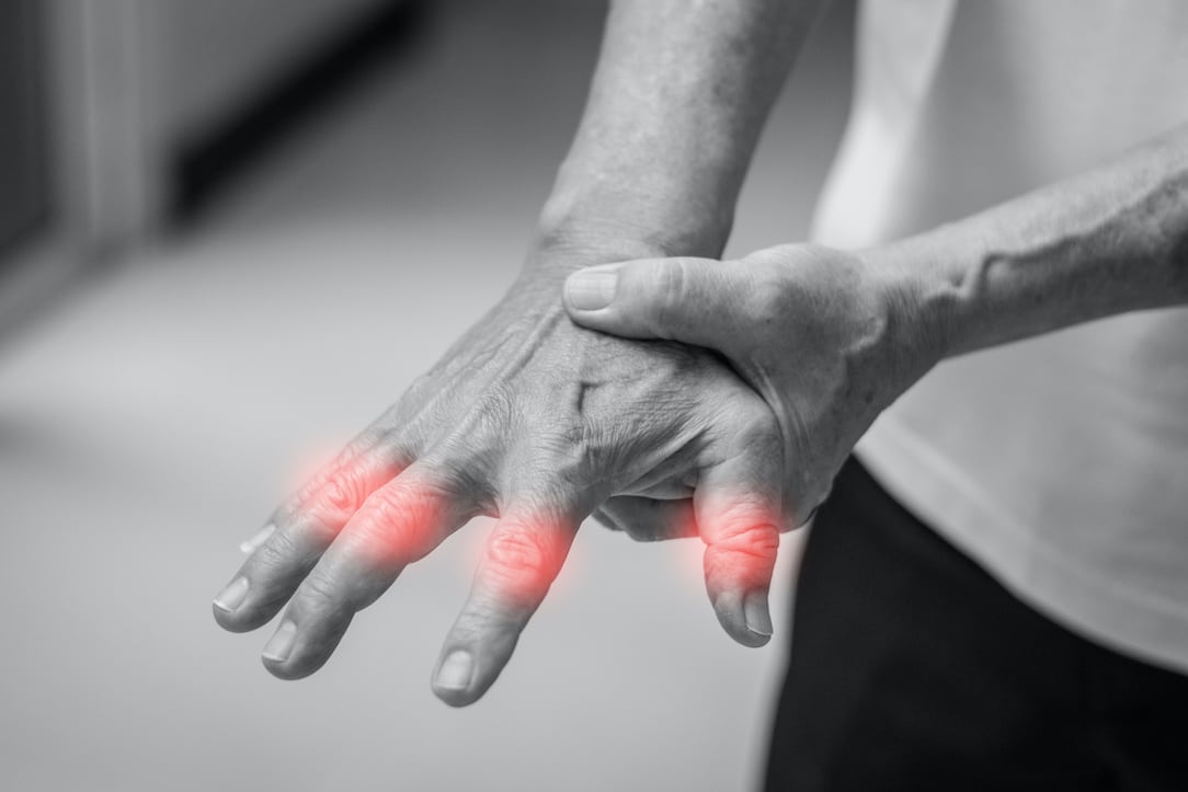 What to Do if You Experience Numbness and Tingling