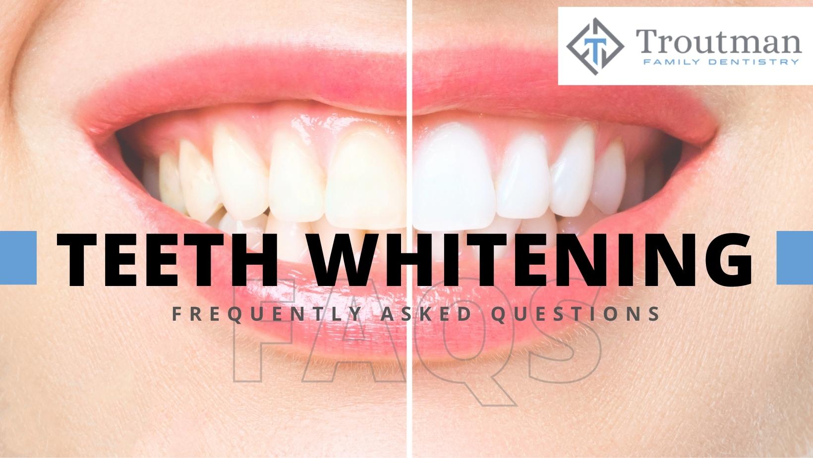 Teeth Whitening FAQs Mebane, North Carolina