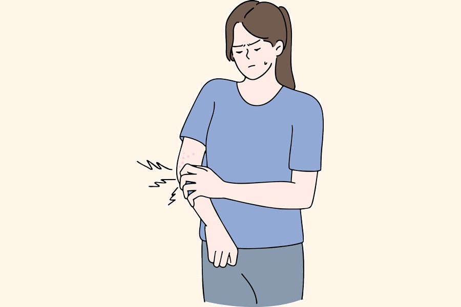 Managing itchy skin during summer heat The Financial Express