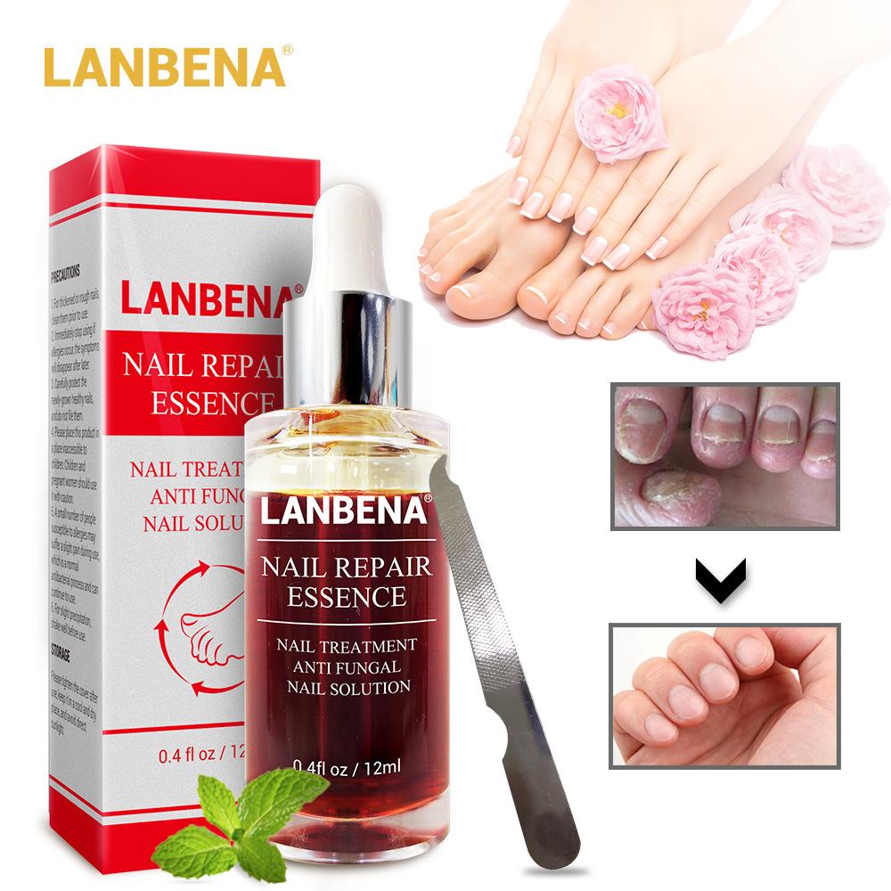 แนะนำ LANBENA เซรั่มรักษาเล็บ น้ำมันบำรุงเล็บ รักษาเล็บ เล็บขบ เชื้้อรา