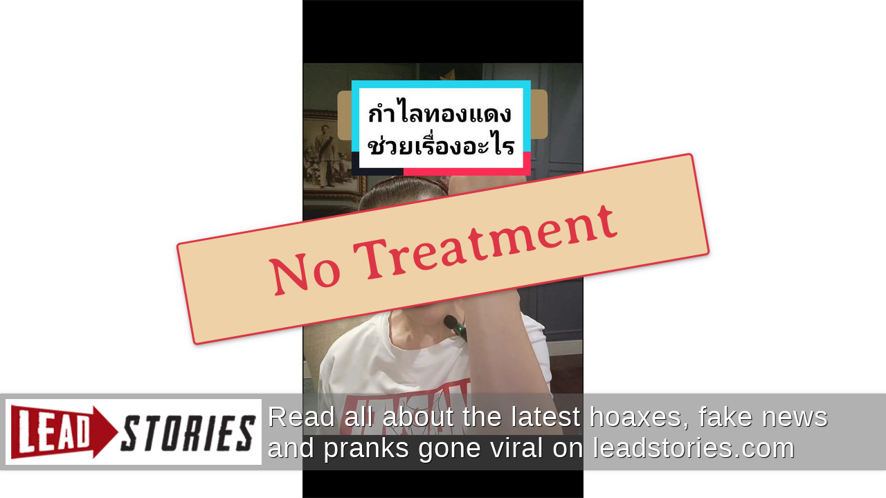 Fact Check NO Evidence Wearing Copper Bracelets Relieves Pain Or Cures