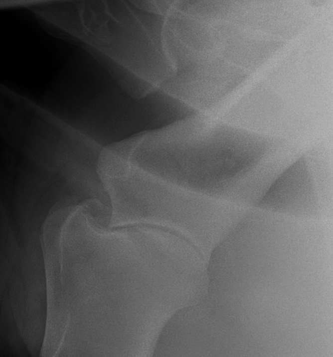 Equine Veterinarian in Santa Fe, NM Thal Equine Regional Equine Hospital