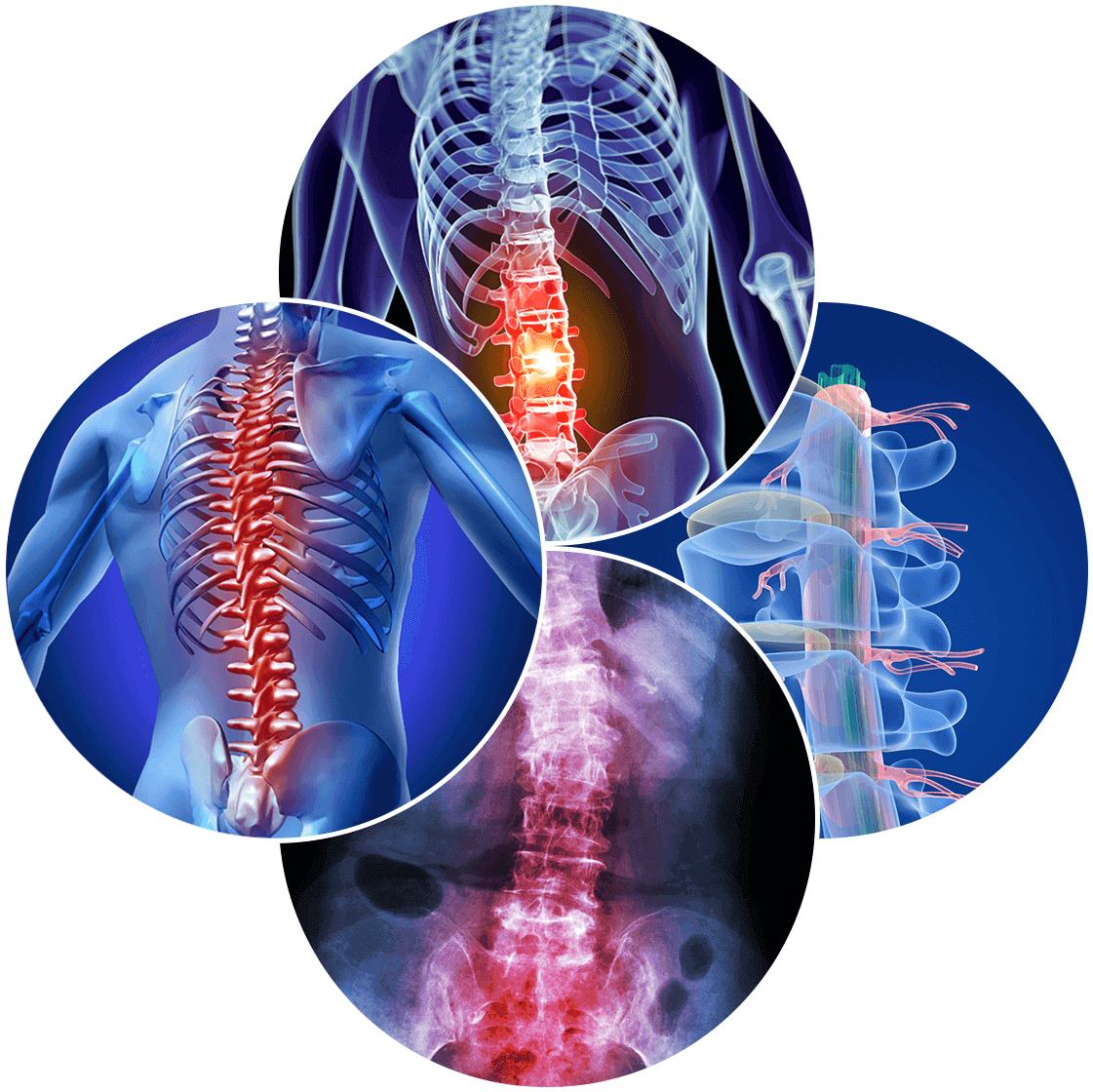 Anterior Lumbar Interbody Fusion Advanced Spine Relief