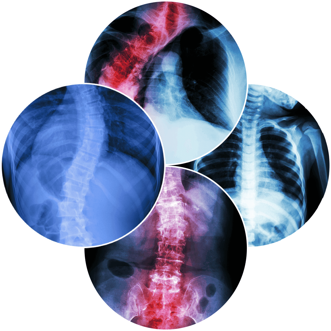 Osteotomy Advanced Spine Relief from NJ's Top Doctors