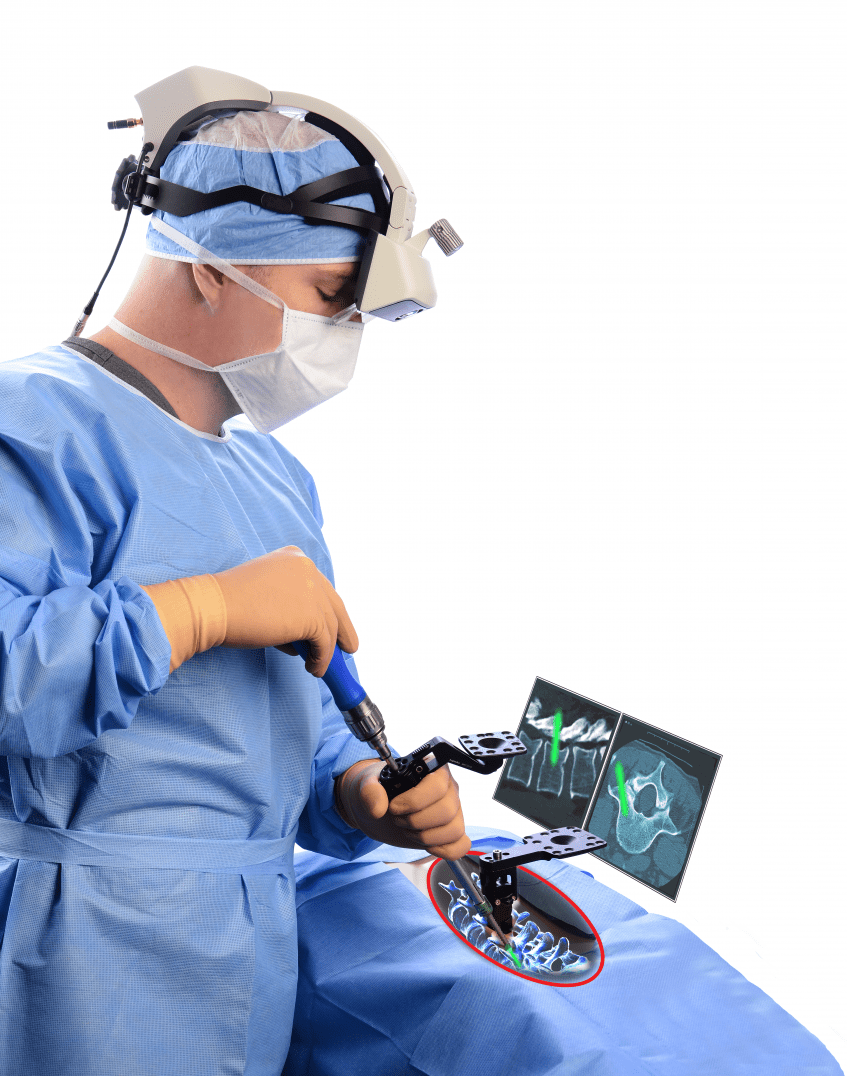 Augmedics Augmented Reality in Spinal Surgery AREA