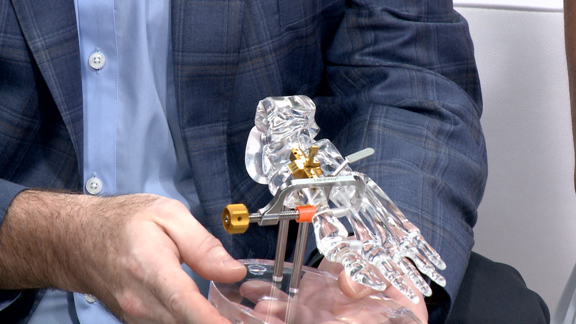 Lapiplasty® 3D Bunion Correction™, Explained The Balancing Act