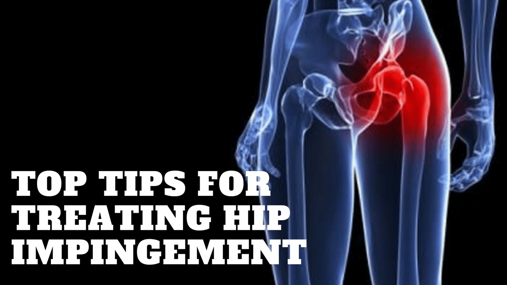 Treating Hip Impingement in the Fitness Athlete The Barbell Physio