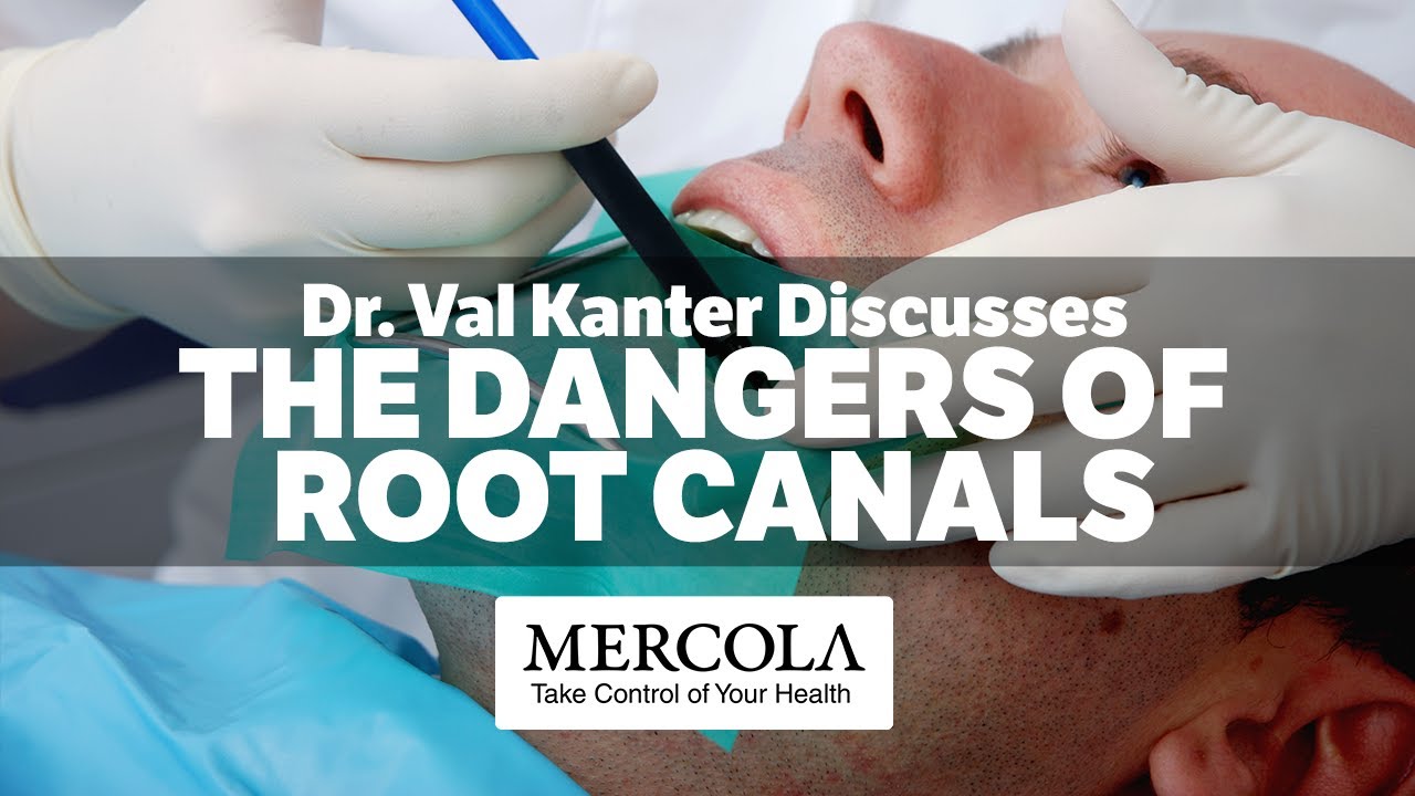 Root Canal Dangers Interview Preview with Dr. Val Kanter The BATTLEFRONT