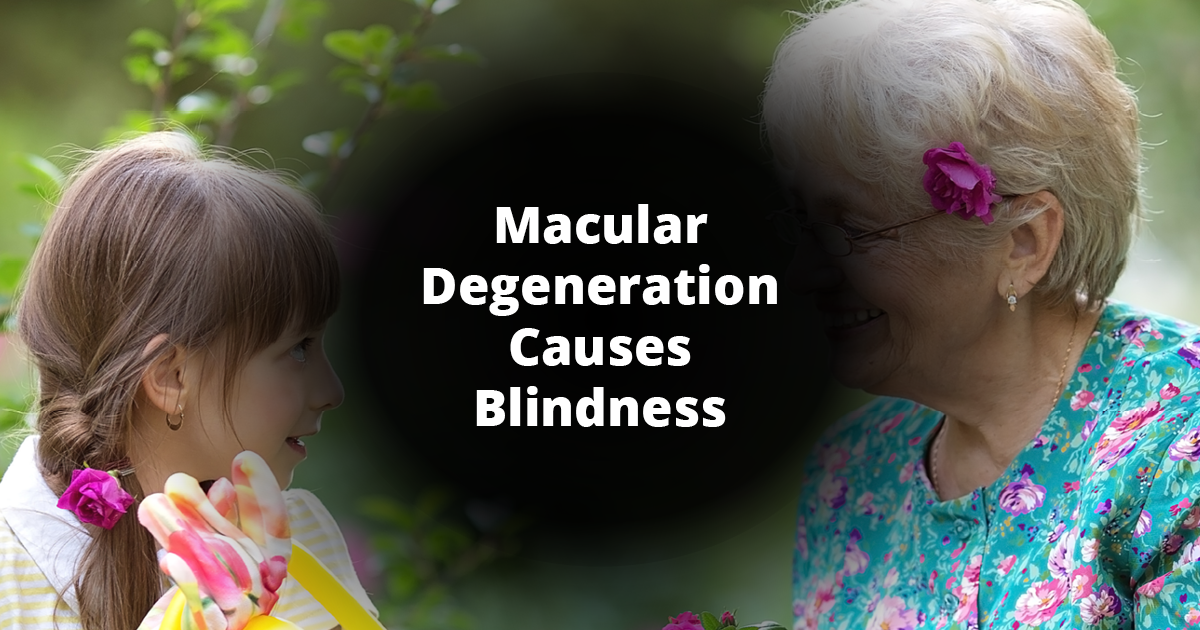 Macular Degeneration Week The Beast