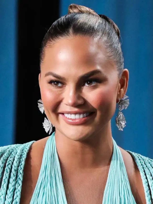Chrissy Teigen Reveals She Had Fat Removed From Her Face