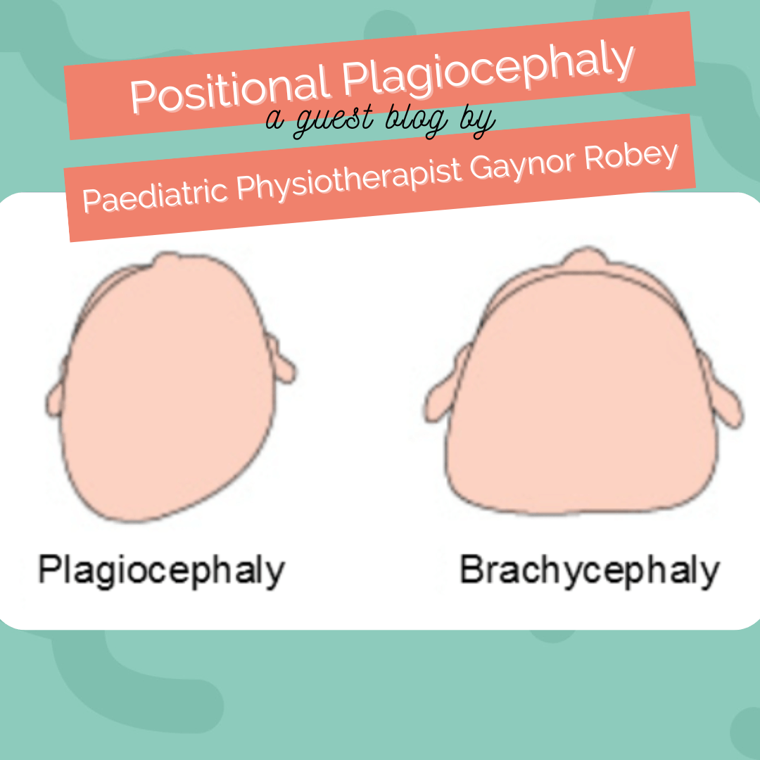 Why does my baby have a flat head? The Bump to Baby Chapter
