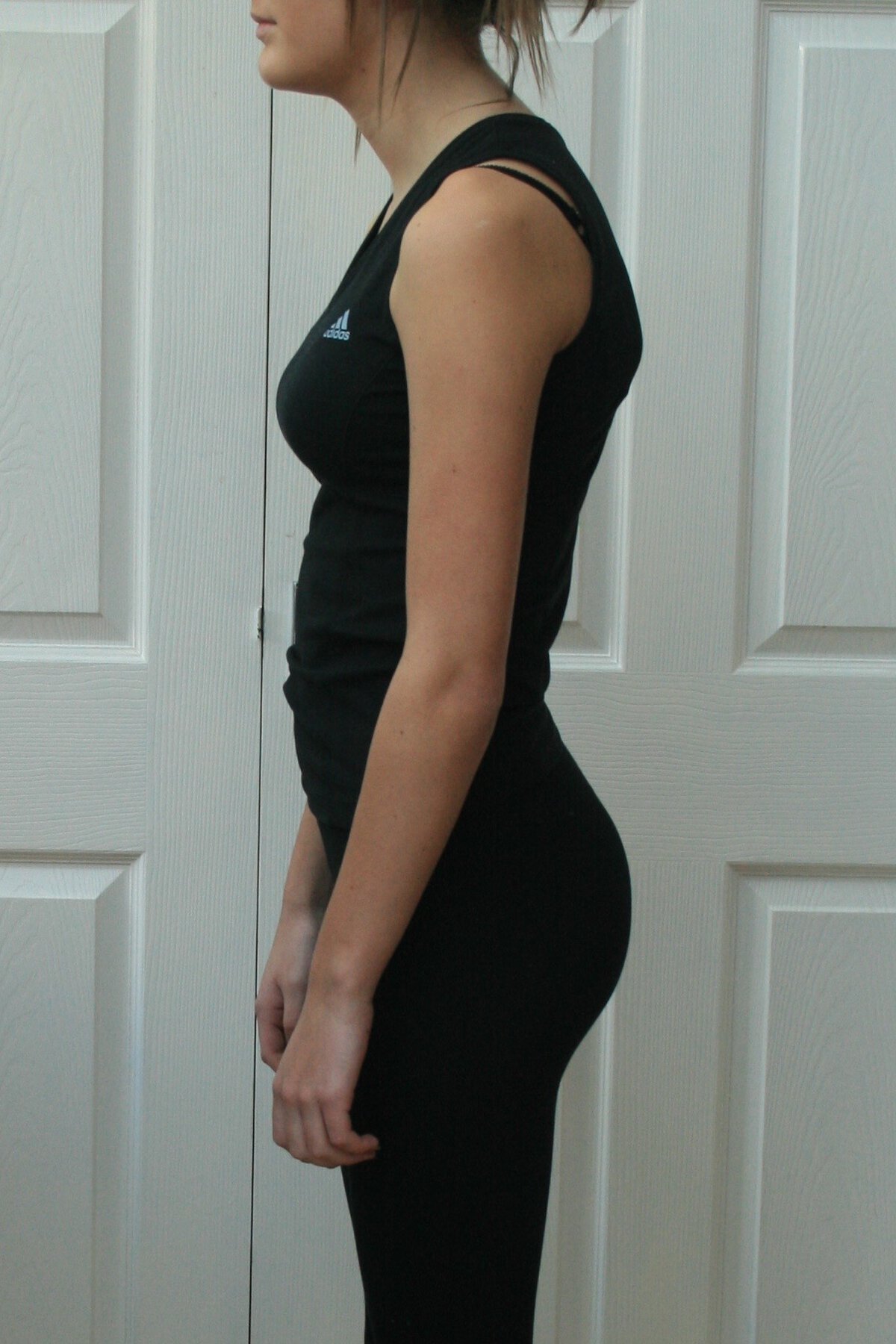 Lordosis what does it mean? The Buttafly