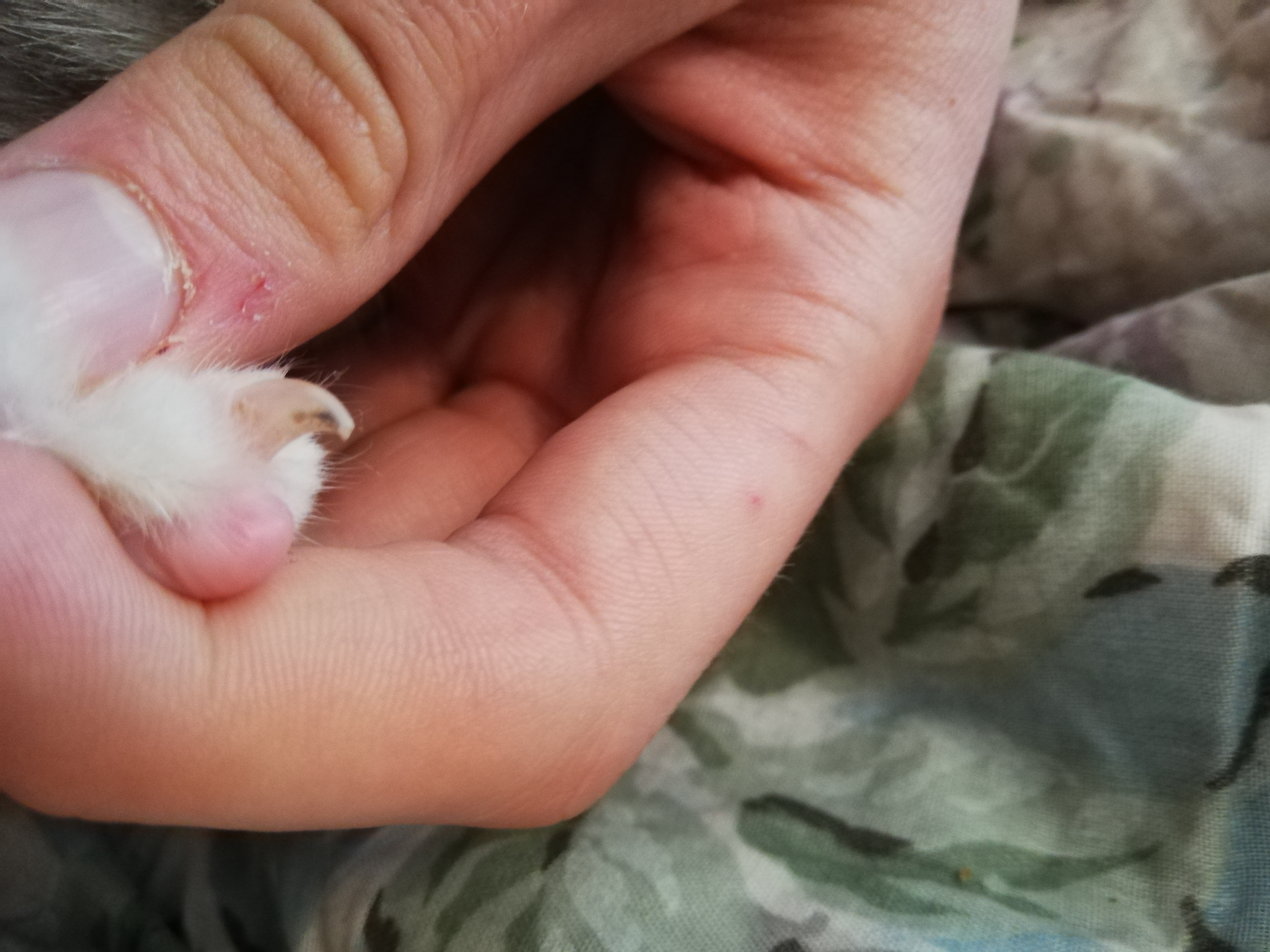 Black Spots In My Cats Claws ( Cut Claws) TheCatSite