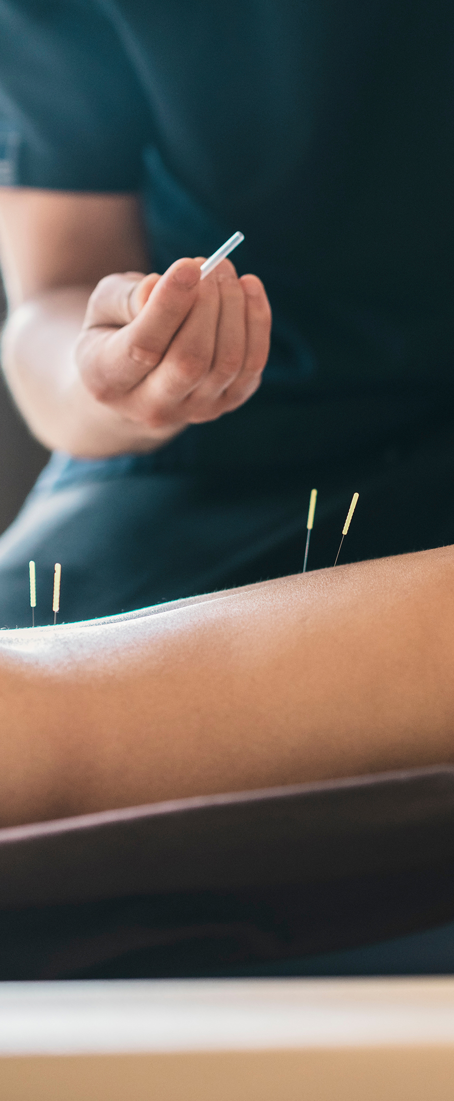 Acupuncture Comprehensive Medical Care New Jersey