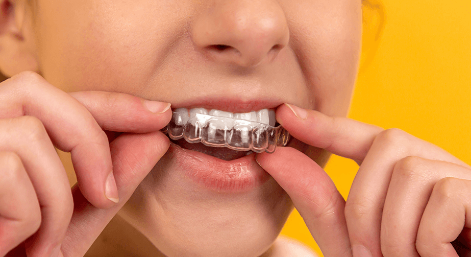 Invisalign Headache Can Invisalign Cause Headaches CDS