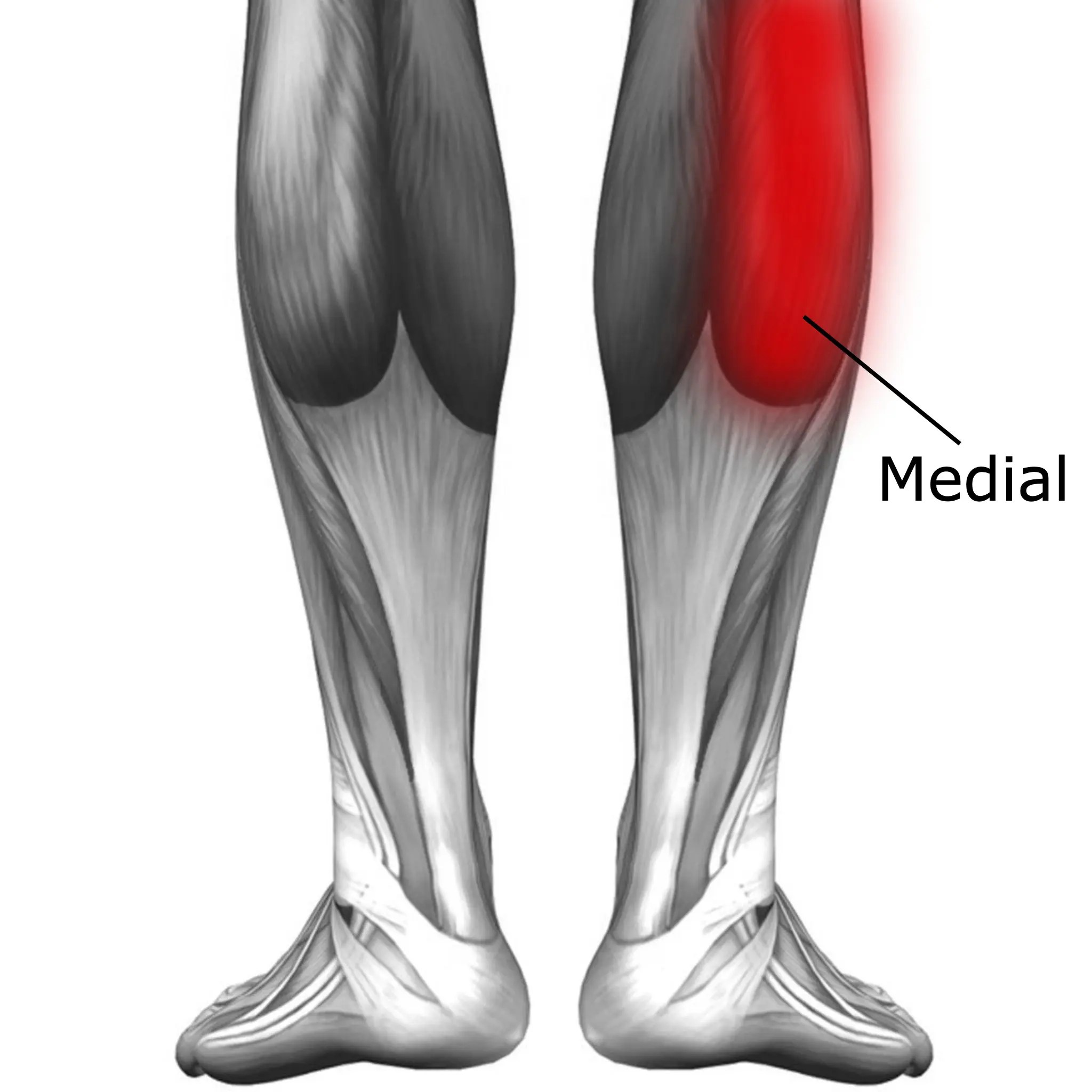 Calf Muscle Strain