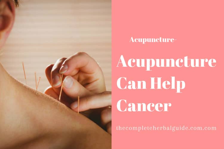 Acupuncture Can Help Cancer Health and Natural Healing Tips