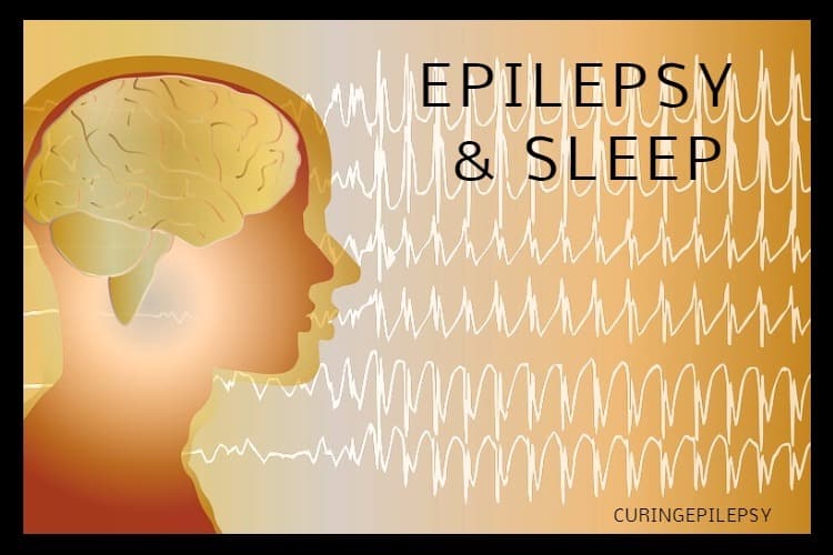 Epilepsy and Sleep Apnea A Collaborative Treatment