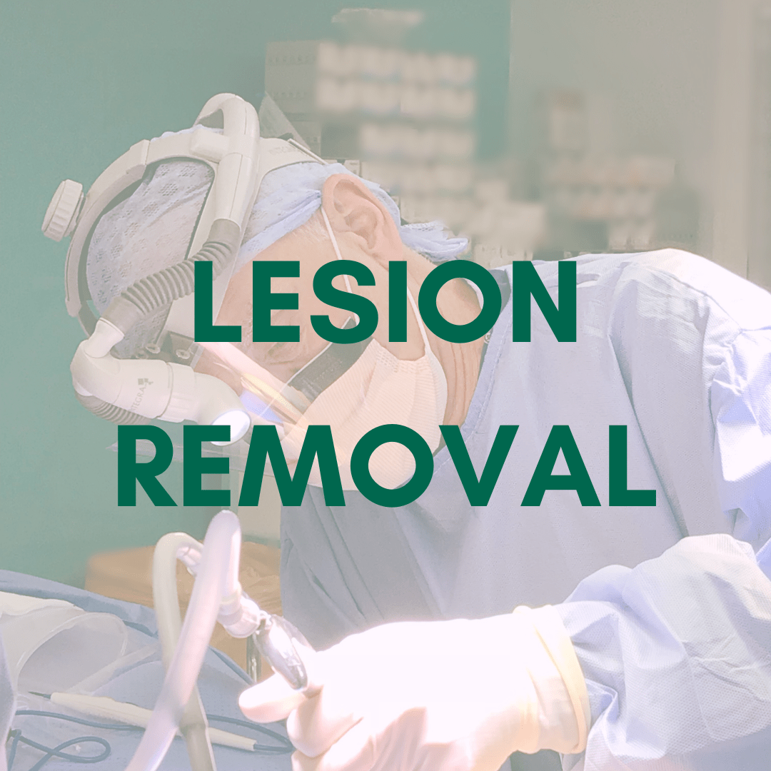 Mole, Cyst and Skin Tag Removal by Mr Adrian Richards The Cosmetic Centre