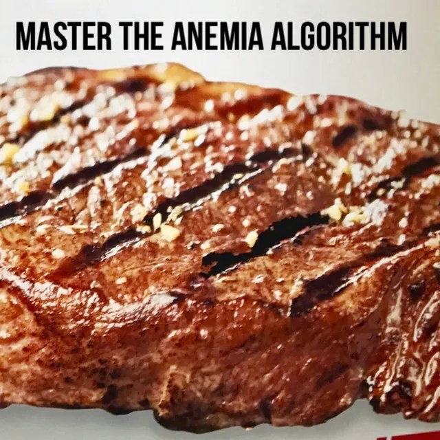 52 Anemia Tips and tools for diagnosis and treatment The Curbsiders