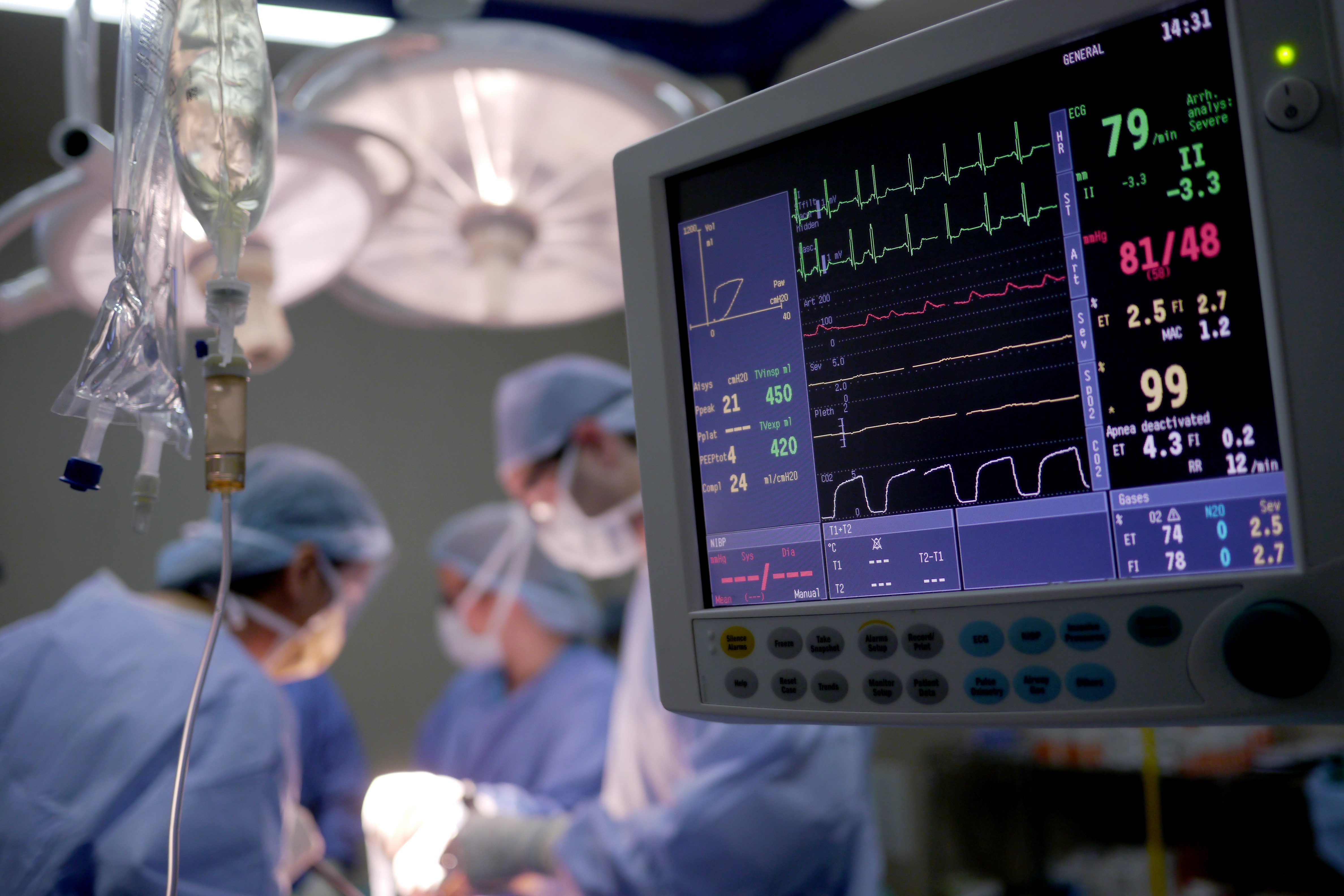Arduino Based Patient Monitoring Overview