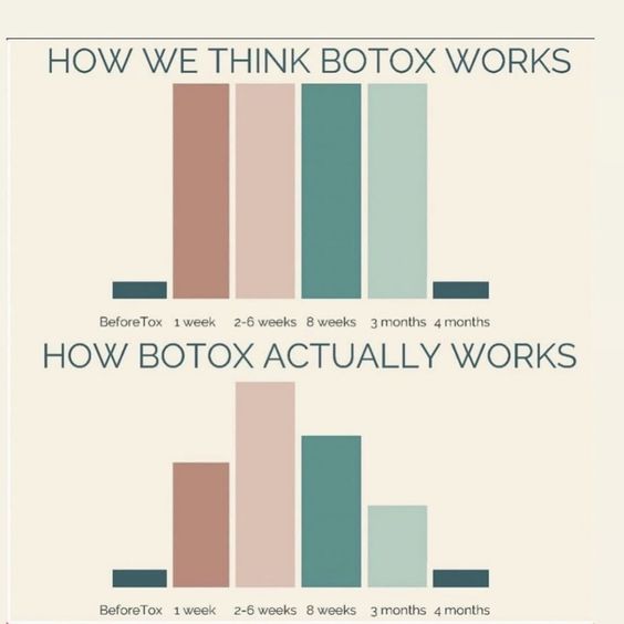 How Long Does Botox Last And How Can You Make It Last Longer the daily glimmer