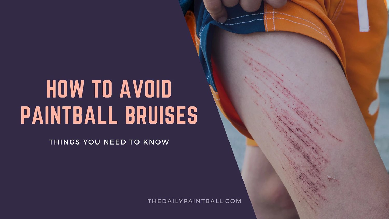 Tips to avoid Paintball Bruises (May 2022) What really Works