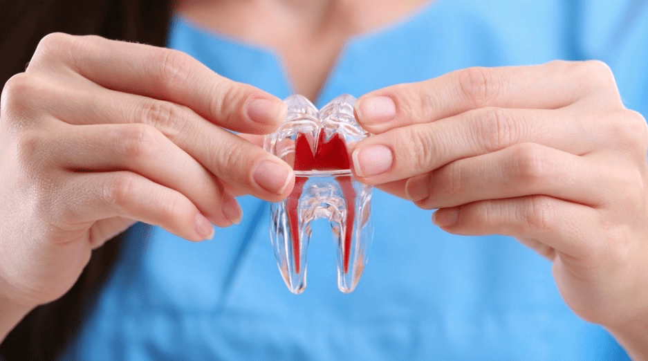 How Long Does it Take to Recover After a Root Canal Procedure?