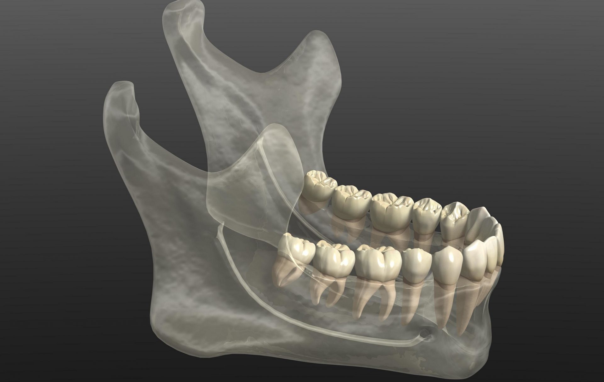 A Few Interesting Points About Jawbone Grafting Fort Worth, TX