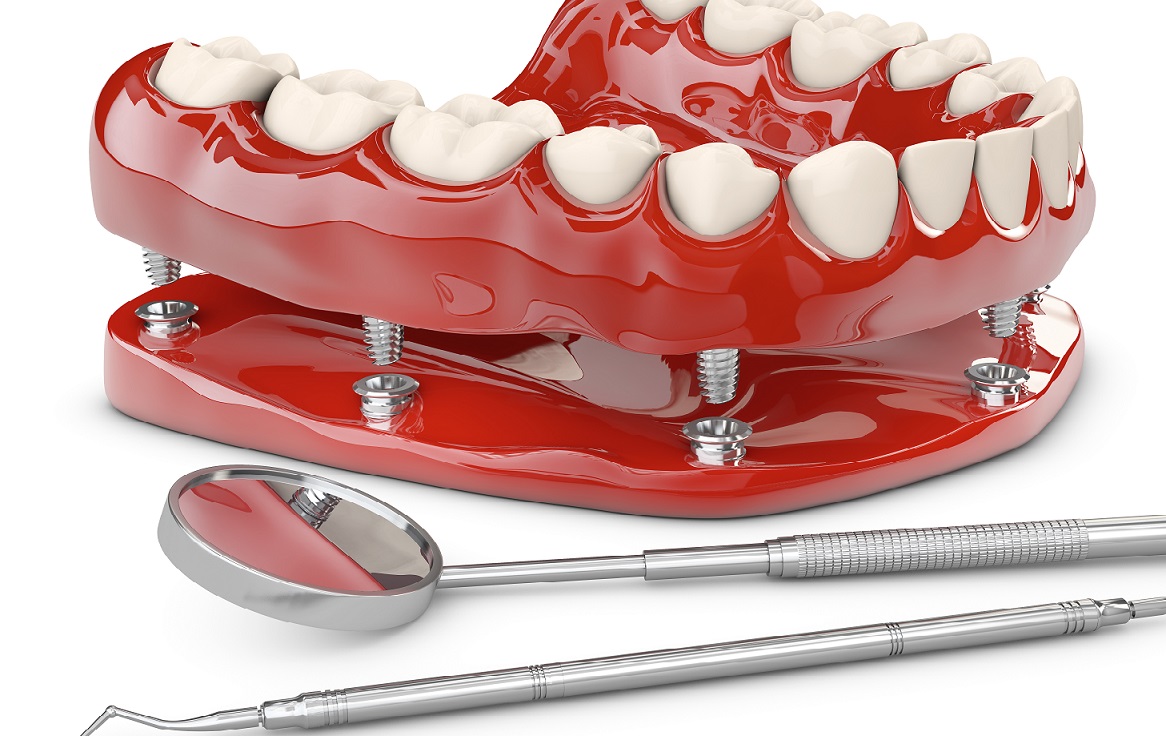 Why Dentures Loose, and How to Prevent It Fort Worth, TX