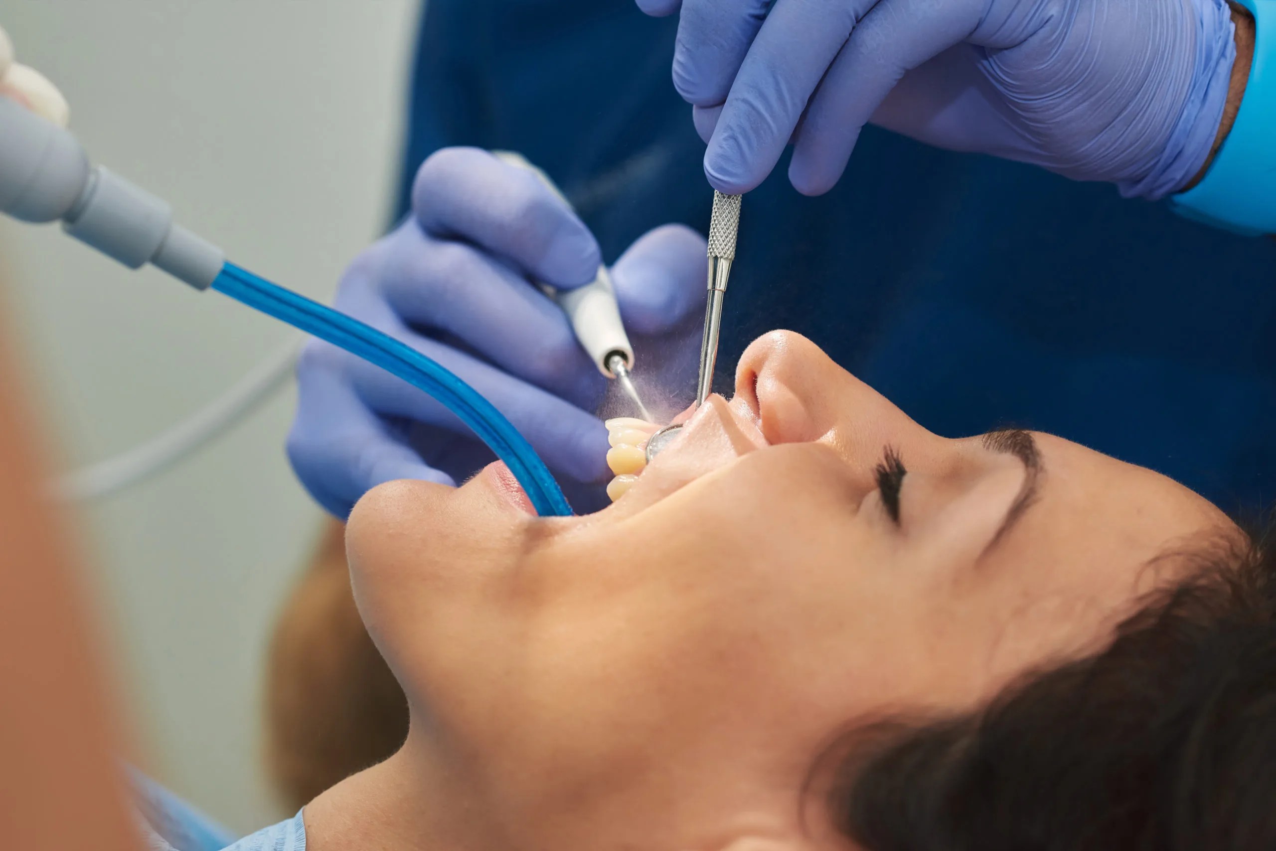 10 Most Common Dental Procedures and How They Work