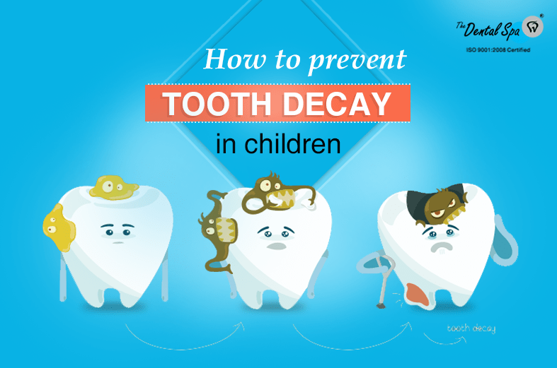 How to Prevent Tooth Decay in Children? The Dental Spa