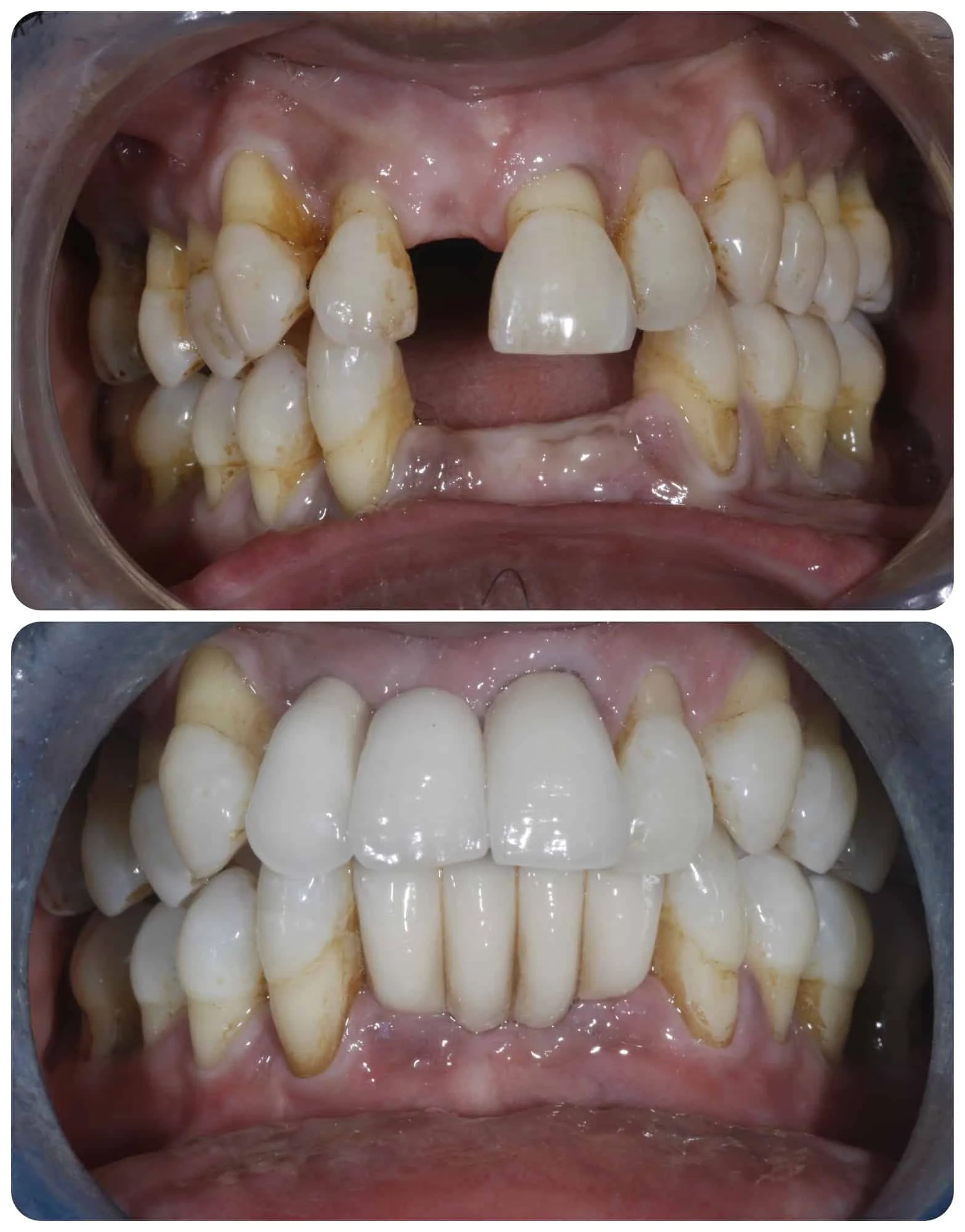 implants The Dentist, Implants, Veneers, Emergency Center