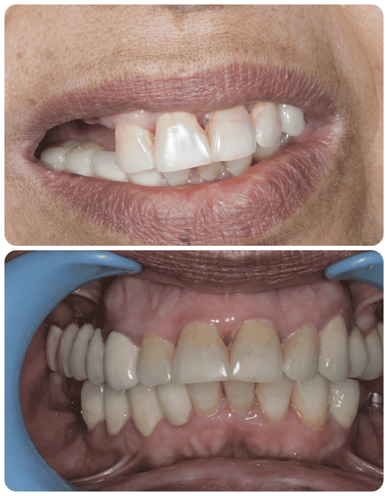 implants The Dentist, Implants, Veneers, Emergency Center