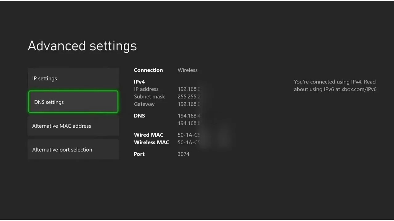 Why Does My Xbox Keep Disconnecting From The Complete Guide