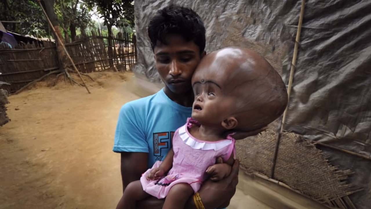 Rooting for Roona Netflix's intense documentary on child suffering