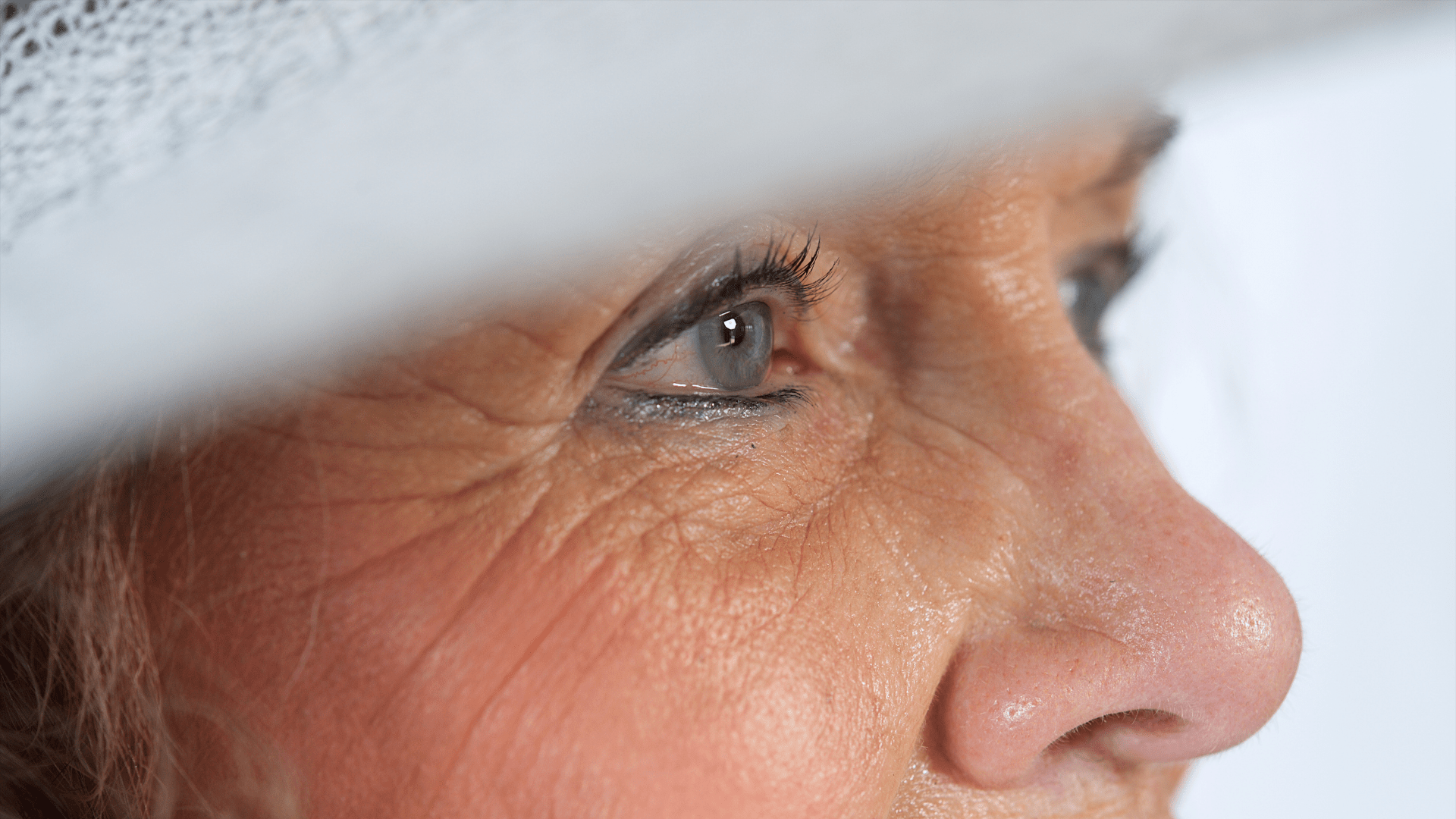 Healing after Cataract Surgery Eye Clinic Surgicenter Red Lodge