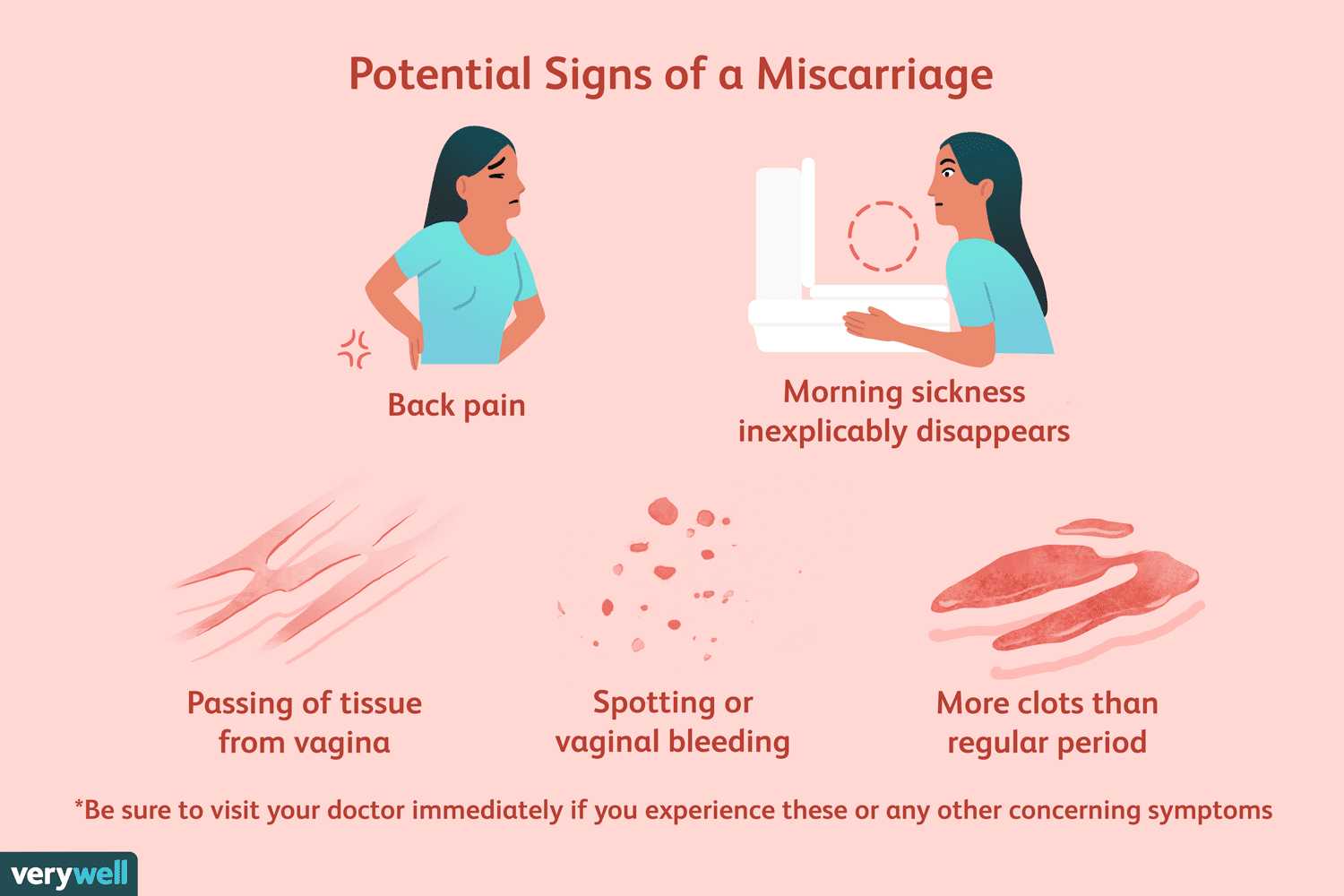 What is a miscarriage?