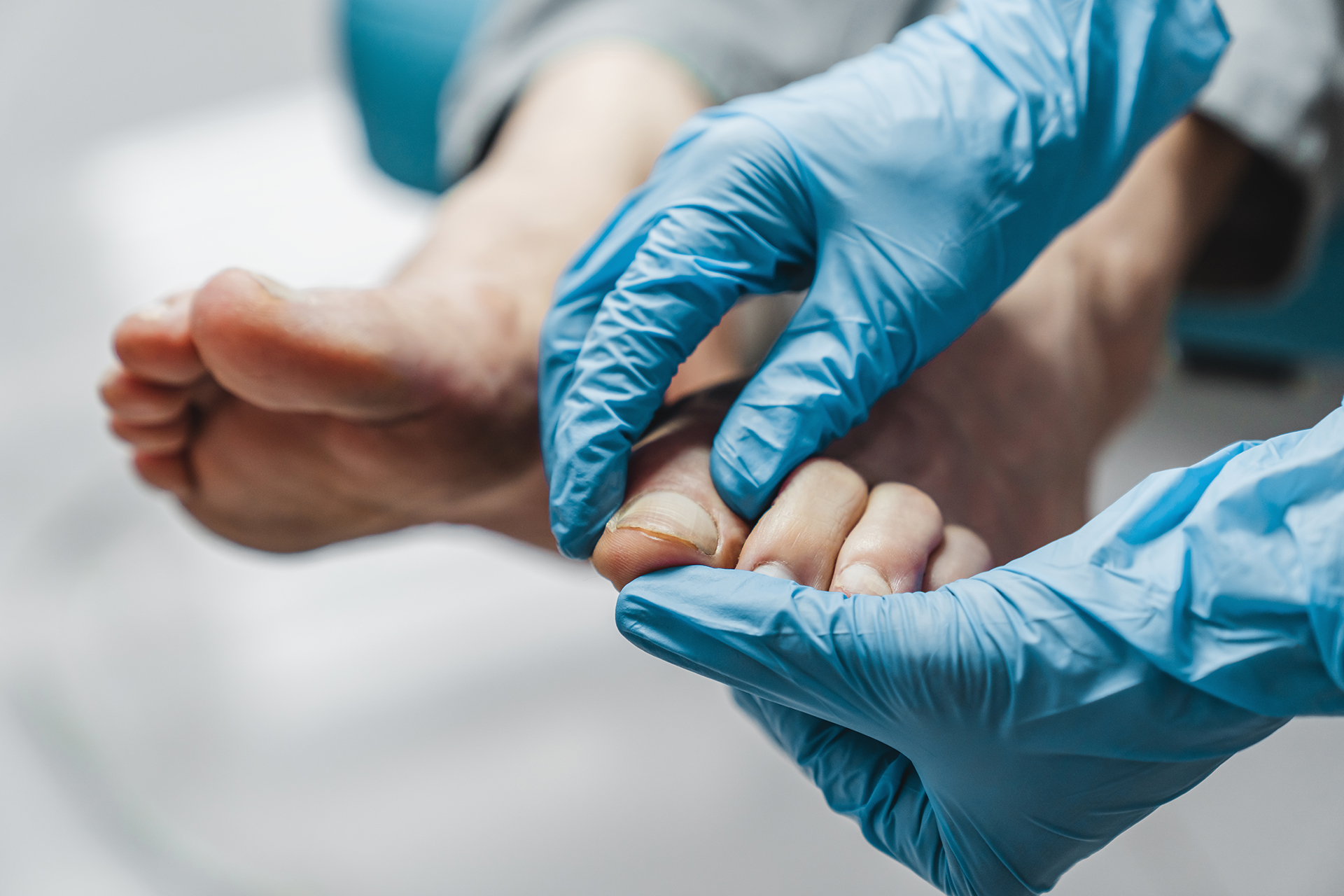 Turf Toe Injury Recovery The Foot Practice Podiatry Singapore