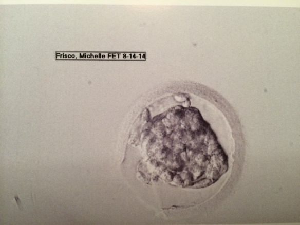 Embryo