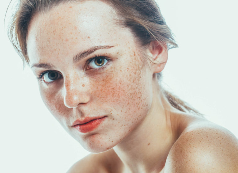 Sun Exposure Effects on Your Skin The Frisky