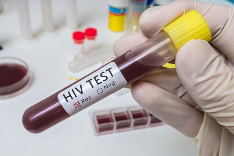 36 Thoughts I Had After Receiving (False) Positive HIV Test Results
