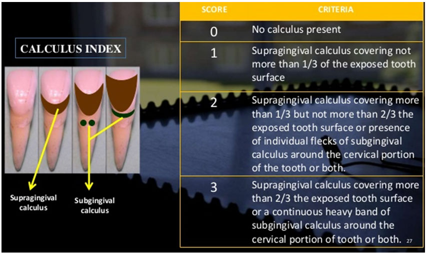 INDICES Focus Dentistry