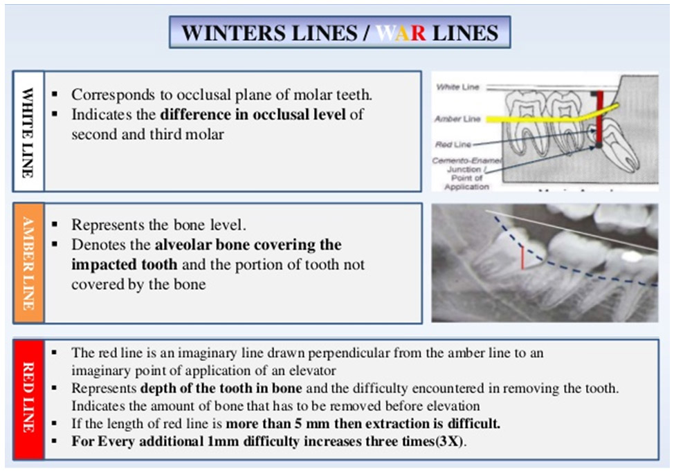 Impaction Focus Dentistry
